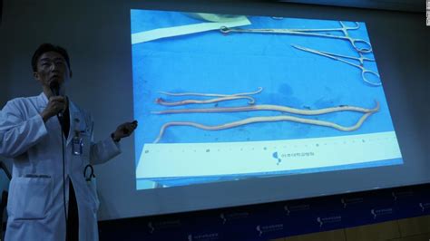 What Parasitic Worms In Defector Reveal About Health Conditions In North Korea Cnn