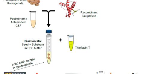 An excess is suggestive of illness. Detection of protein-aggregates for differential diagnosis of dementias by RT-DEM | Health~Holland