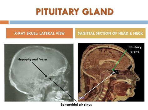 Ppt Anatomy Of The Pituitary Gland Powerpoint Presentation Free