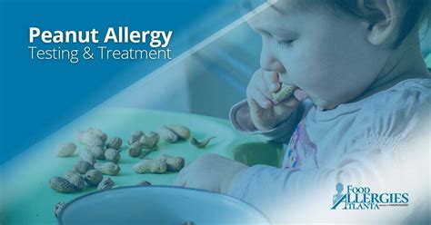 Peanut Allergy Treatment And Best Practices Food Allergies Atlanta