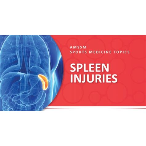 Ruptured Spleen Symptoms