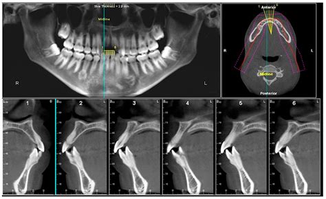 Dentistry Journal Free Full Text Cone Beam Computed Tomography In