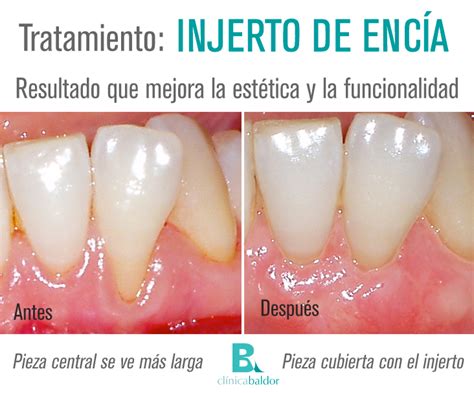 Simple Science: How to Make a Volcano with Kids