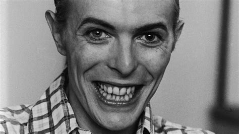 The Truth About David Bowies Teeth