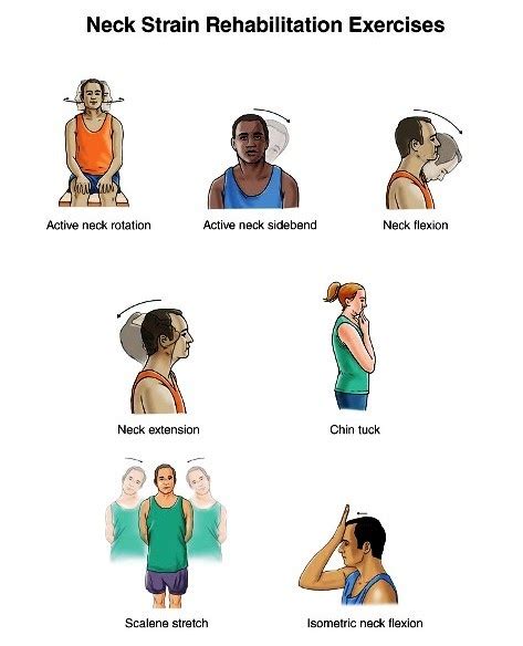 EXCLUSIVE PHYSIOTHERAPY GUIDE FOR PHYSIOTHERAPISTS NECK STRAIN EXERCISES