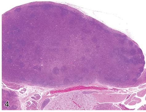 A Much Enlarged Mandibular Lymph Node Of A Mouse With Ulcerative Skin