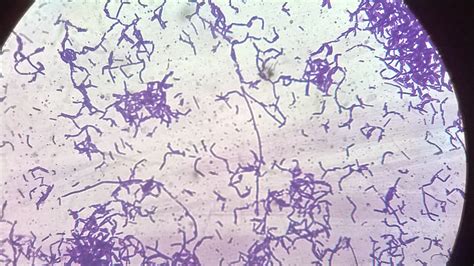 Lactobacillus Colony Morphology
