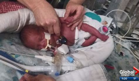 Premature Baby Born At Weeks Weighed Just Pound But Now He S