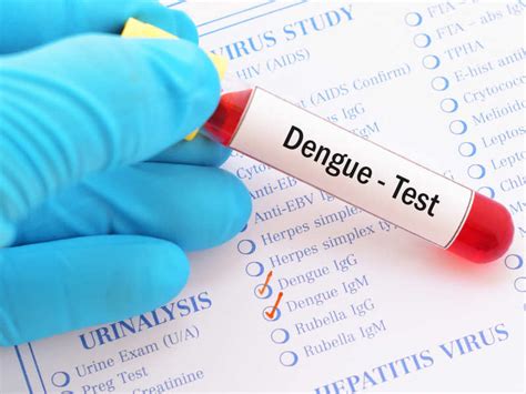 Dengue Tests How To Diagnose Dengue Fever Times Of India