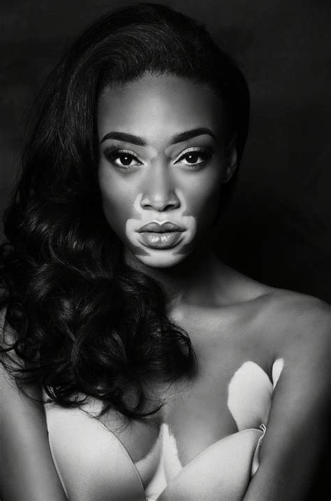 Winnie Harlow Is Changing Beauty Standards Cnnit1jx4mg9 Black Is