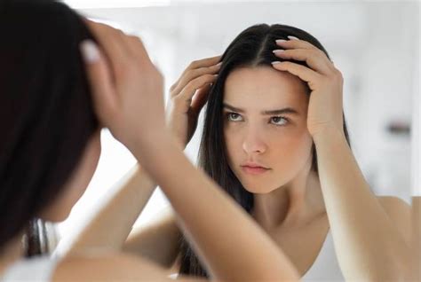 Les symptômes du Covid long peuvent inclure la perte de cheveux et des