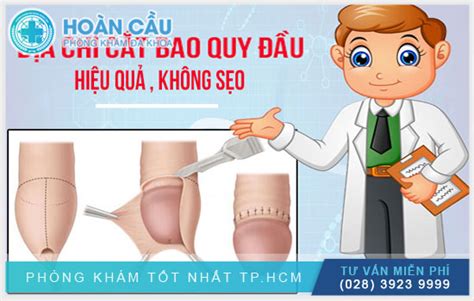 Cắt Bao Quy đầu ở đâu Vừa Tiết Kiệm Chi Phí Vừa An Toàn