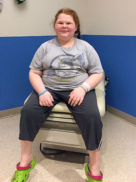 alexis shapiro 13 year old who suffered from uncontrollable weight gain begins brain tumor