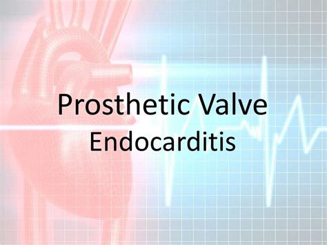 Ppt Prosthetic Heart Valves Powerpoint Presentation Free Download
