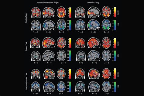 How Does Fmri Work In The Study Of Brain Activity Study Poster