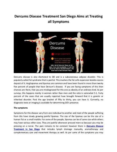 Dercums Disease Treatment San Diego Aims At Treating All Symptoms