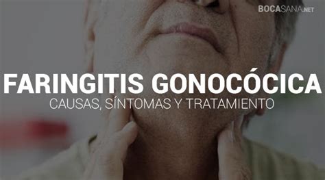 ⊛ Faringitis Gonocócica 【 Causas Síntomas Y Tratamientos