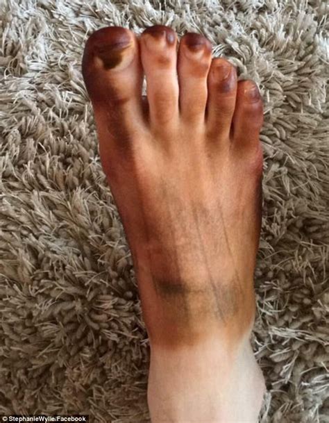 Men Share Pictures After Women Use Their Socks As Fake Tanning Mitts