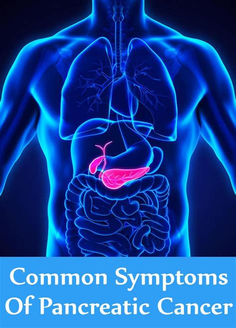 Common Symptoms Of Pancreatic Cancer Lady Care Health