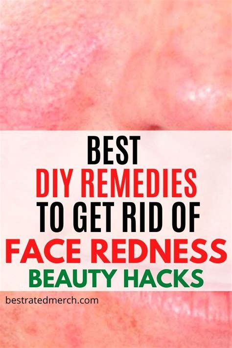 How To Get Rid Of Red Spots On Skin Frequently Asked Questions