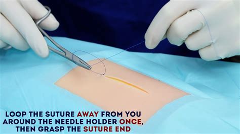 Simple Interrupted Suture Osce Guide Wound Suturing Geeky Medics