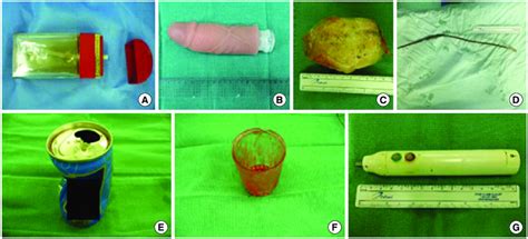 Images Showing A Variety Of Extracted Rectal Foreign Bodies A A Download Scientific Diagram