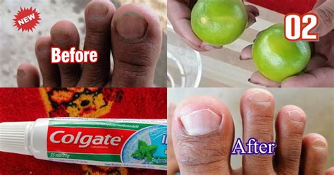 How To Clean Toenails At Home Without Equipment R Beauty Tips R