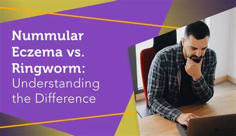 Nummular Eczema Vs Ringworm Understanding The Difference Myeczemateam