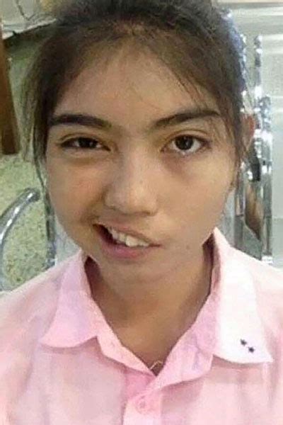 Thai Schoolgirl Learns To Smile Again After Teacher Assault Asia World News Asiaone