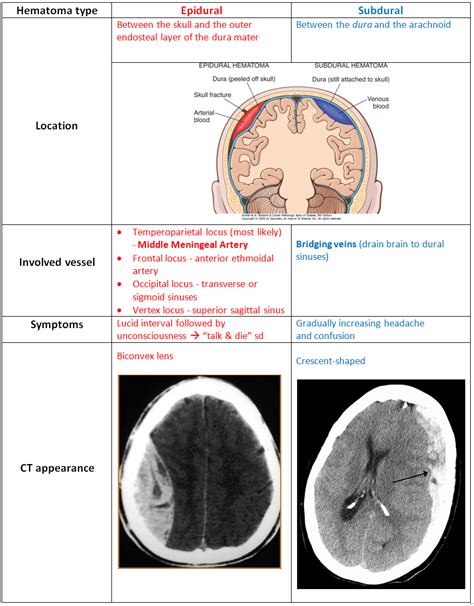 Epi = above dural , sub = below dural (potential space between dura ( inserts firmly into each sutures) and arachnoid). Resultat d'imatges de hematoma subdural vs epidural ...