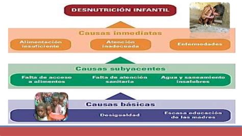 Trastornos Nutricionales En Pediatria Marasmo Kwashiorkor Mixta Ppt