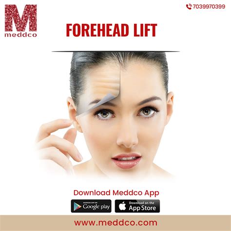 A Complete Guide To Forehead Lift Part 2