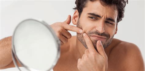 How To Pop A Pimple Reasons Why They Spread And How To Prevent Them