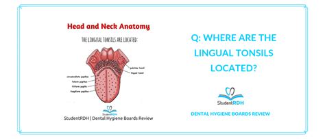 Palatine Tonsils Anatomy Anatomical Charts And Posters