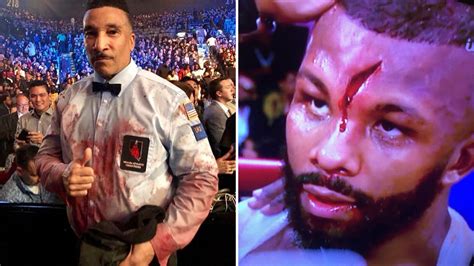 That was a boiled down cruiser in there tonight. Badou Jack Suffers A Horrific Cut Against Marcus Browne On ...