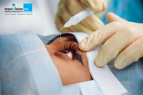 Robotic Cataract Surgery Everything You Should Know Maxivision Eye Hospitals
