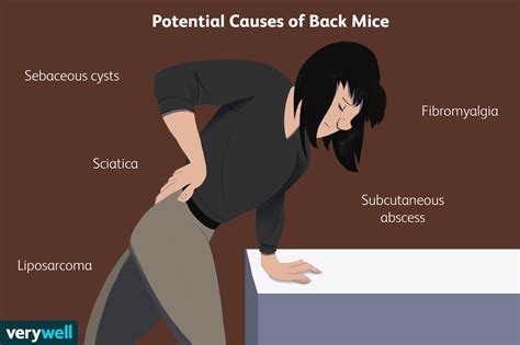 Back Mice Symptoms And Diagnosis