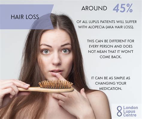 Did You Know That Lupus Can Lead To Hair Loss