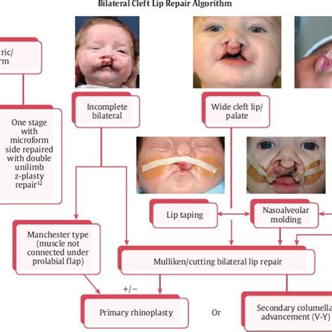 Pdf Cleft Lip And Palate Protocol For Orthodontics Treatment