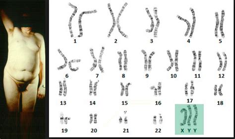 Las Anomalias Cromos Micas Sexuales Banco De Preguntas De Biolog A