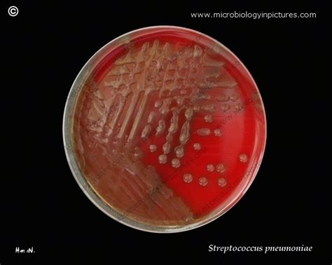 A Virulent Strain Of Streptococcus Pneumoniae Pneumococcus Growing On