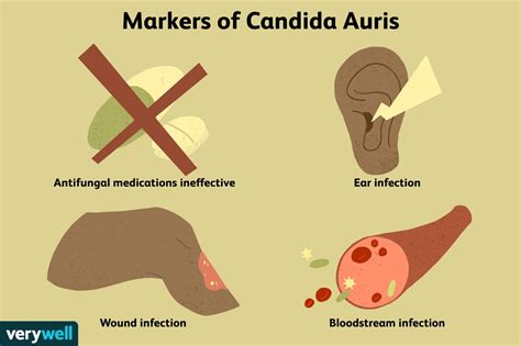 Candida Auris Symptoms Causes Diagnosis Treatment