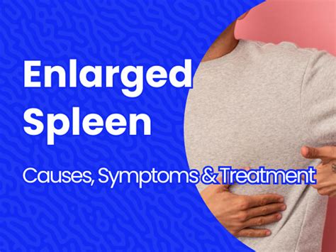 Enlarged Spleen Causes Symptoms And Treatments Massive Bio
