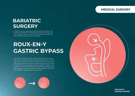 Roux En Y Gastric Bypass Rny Weight Loss Surgery Vector Illustration Icon 14818806 Vector Art At
