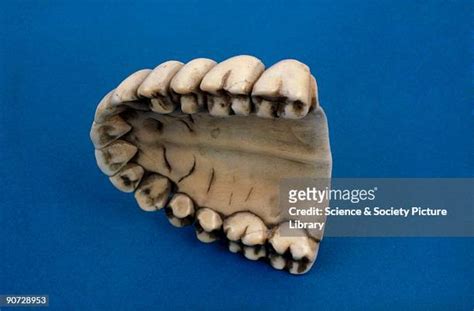 Palatal Photos And Premium High Res Pictures Getty Images