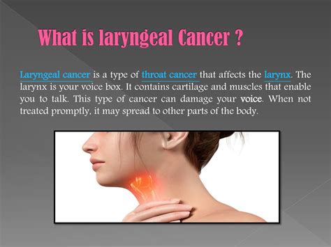 Ppt Laryngeal Cancer Symptoms Causes Diagnosis And Treatment