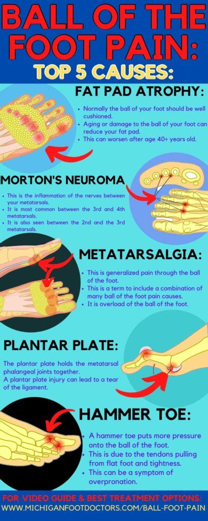 Do You Have Sharp Pain In The Ball Of Foot Causes And Best Treatment