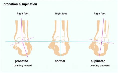 Pronation And Supination Whats All That About Ariki Holidays
