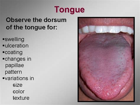 Module 5 Oral Cancer Examination Oral Cancer Exam