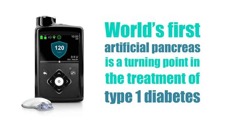 Worlds First Artificial Pancreas Is A Turning Point In The Treatment